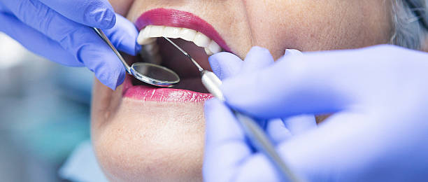 Best Emergency Wisdom Teeth Removal in Bell Acres, PA